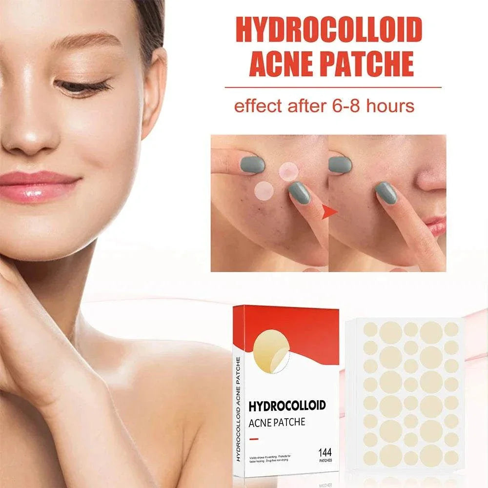 High-End Acne Patches hydrocolloid spot treatment for pimples, 144pcs set, invisible and healing acne stickers