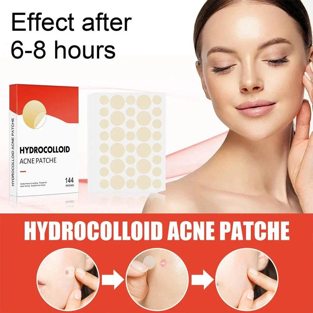 High-End acne patches with hydrocolloid technology for fast healing and invisible spot treatment, 144pcs set