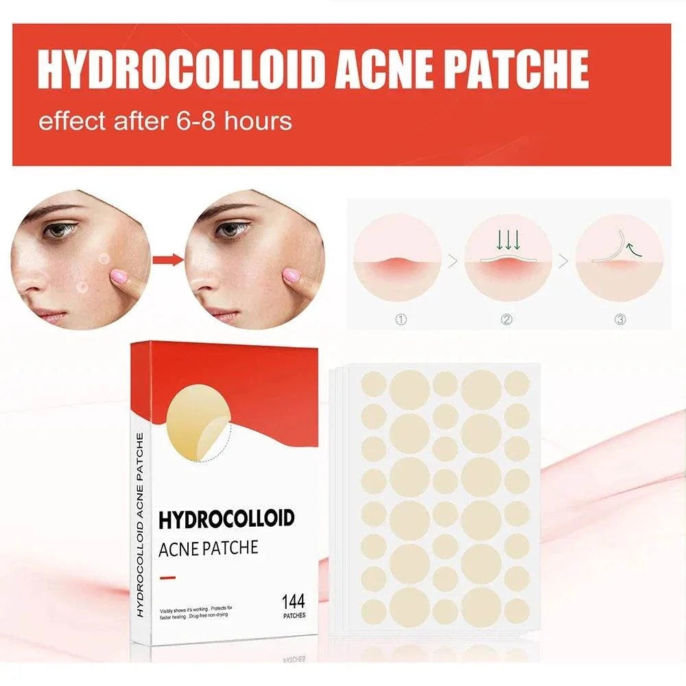 High-End Acne Patches hydrocolloid spot treatment with 144 ultra-thin healing patches for pimples and blemishes, invisible and protective.