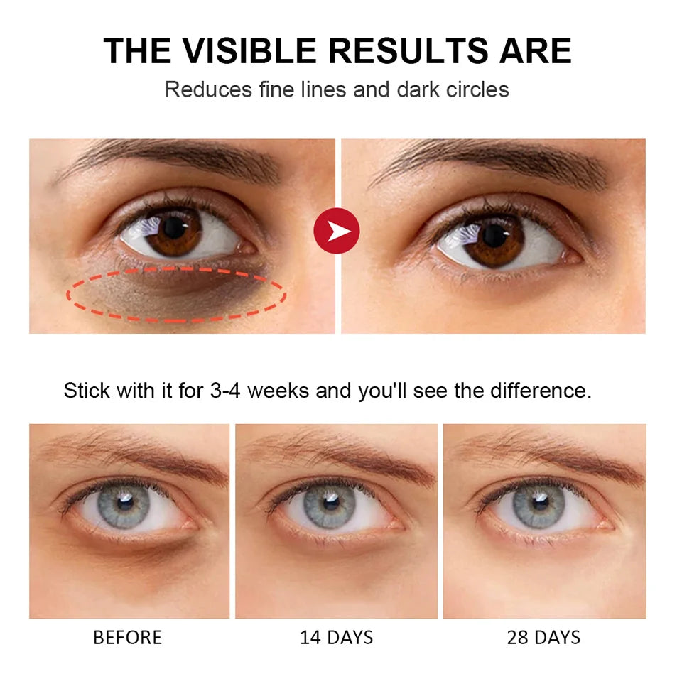 Retinol Eye Cream Stick ā Lightens Dark Circles & Firms Skin Instantly