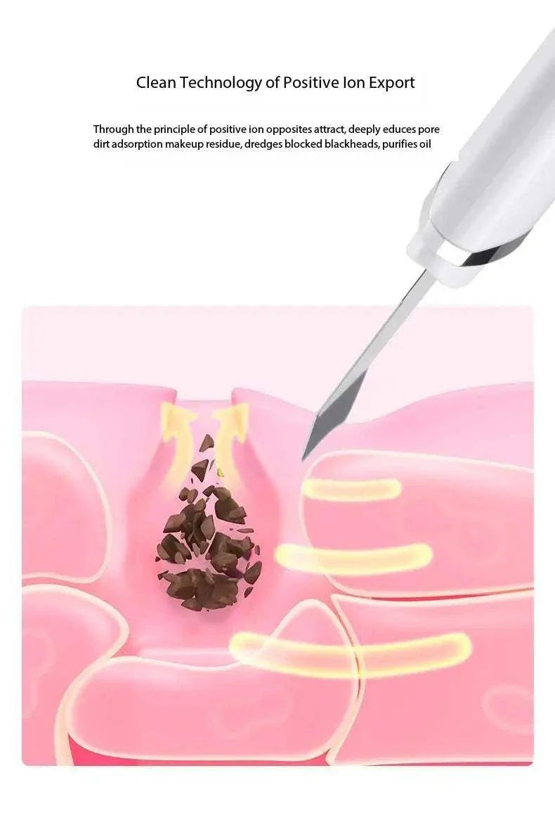 Blackhead remover device illustrating deep pore cleansing by extracting blackheads and impurities using positive ion technology.