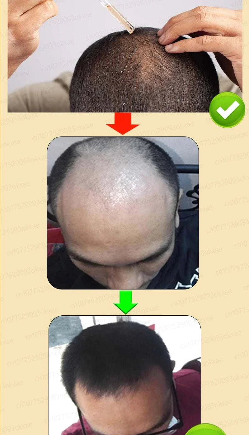 Before and after images showing the effectiveness of hair growth treatment on a balding man's scalp with visible hair regrowth results
