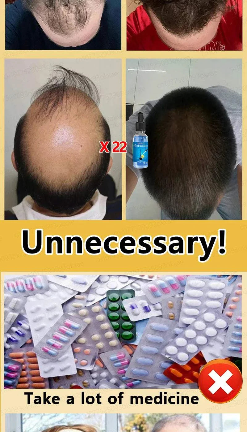 Before and after comparison of hair growth treatment showing significant hair regrowth and fullness, contrasted with image of many medicine pills labeled as unnecessary.