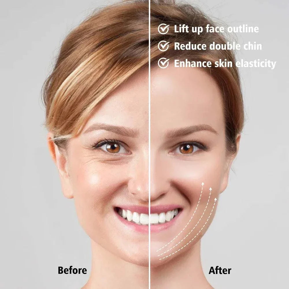 Before and after comparison of a woman's face showing lifted face outline, reduced double chin, and enhanced skin elasticity using EMS Face Lifting Massager