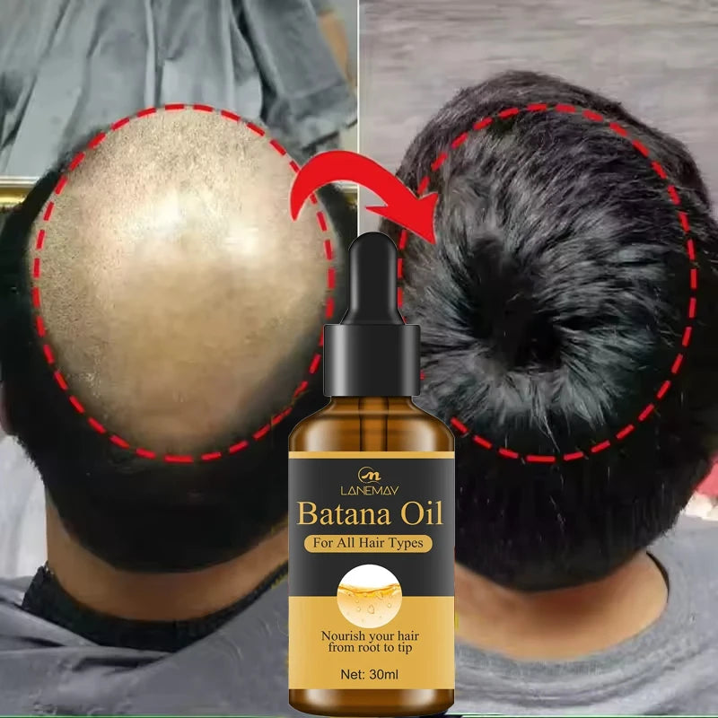 7 Days Fast Batana Oil Hair Growth Serum
