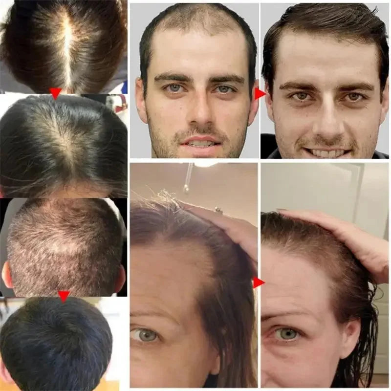 7 Days Fast Batana Oil Hair Growth Serum