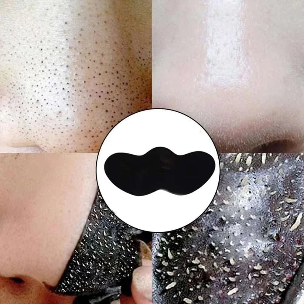 Facial blackhead removal stickers showing before and after nose pore cleansing results with blackhead extraction effect.