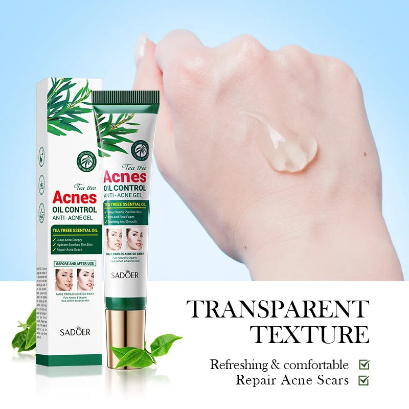 SADOER Tea Tree Acne Removing Cream tube with box and transparent gel swatch on hand for acne and oil control