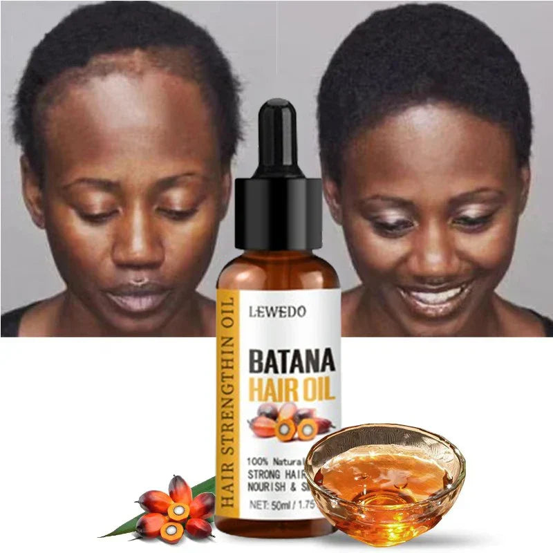 Lewedo Naturals Batana Oil for hair growth and deep nourishment with before and after results
