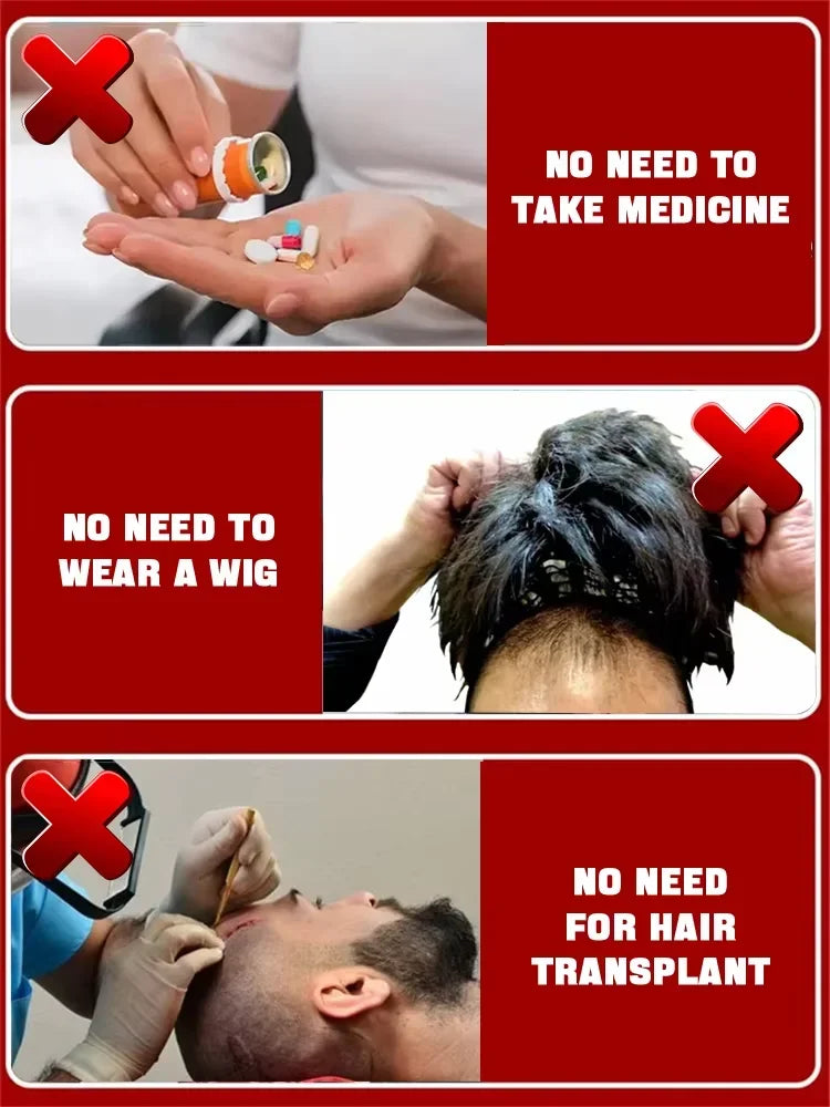 Blue Bottle Hair Growth alternative to medicine wigs and hair transplants for hair restoration