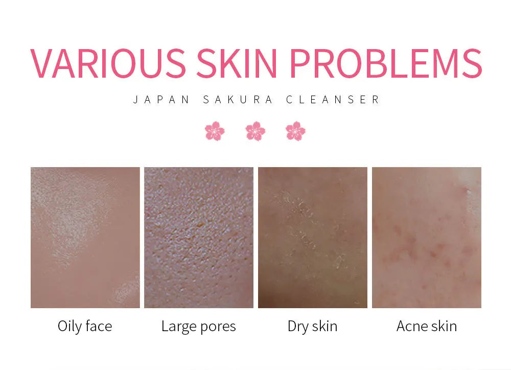 LAIKOU Facial Foaming Cleanser β Deep Cleansing & Oil Control