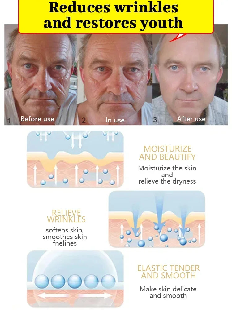 20 years younger, 100% wrinkles disappear