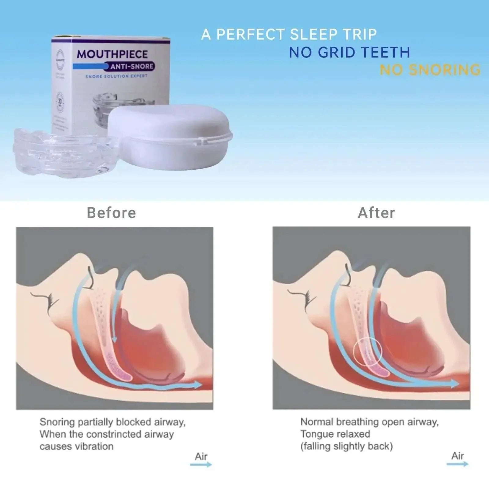 Adjustable anti-snoring mouth guard with customizable fit, reduces snoring and teeth grinding, includes storage case.