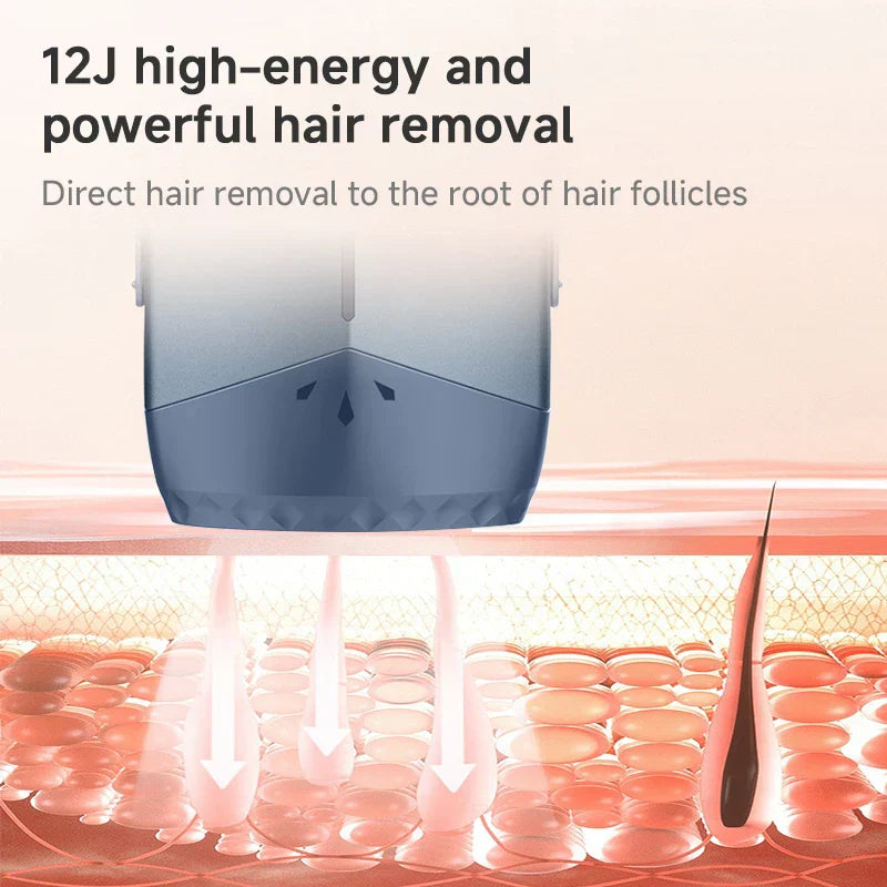 Mlay T18 ICE Cooling IPL hair removal device with advanced cooling and powerful 12J energy for painless, permanent full-body use
