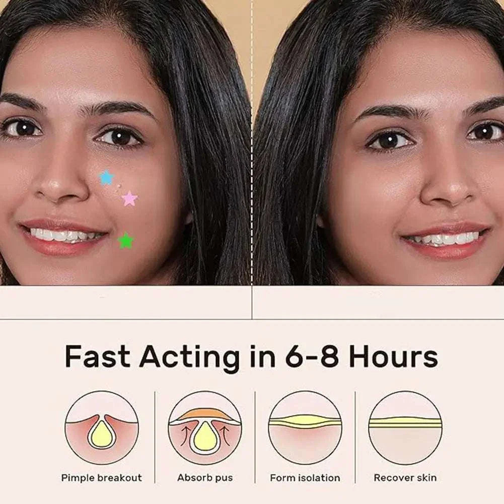 Woman with colorful star pimple patches on cheek showing acne treatment results in 6-8 hours with clear skin after use