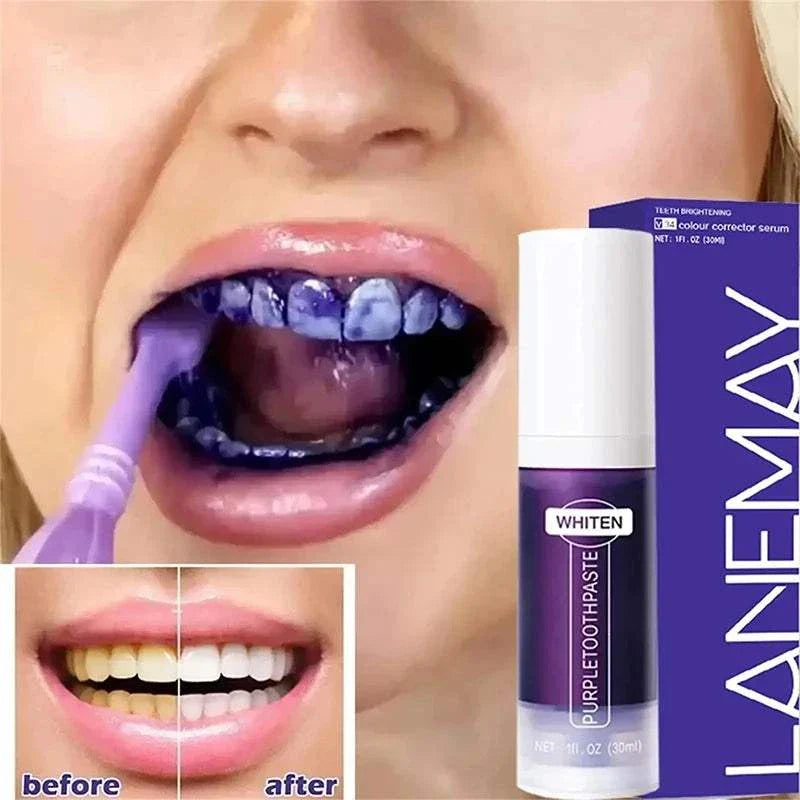 5D Teeth Whitening Stick applicator showing purple formula on teeth with before and after brightening results and product packaging