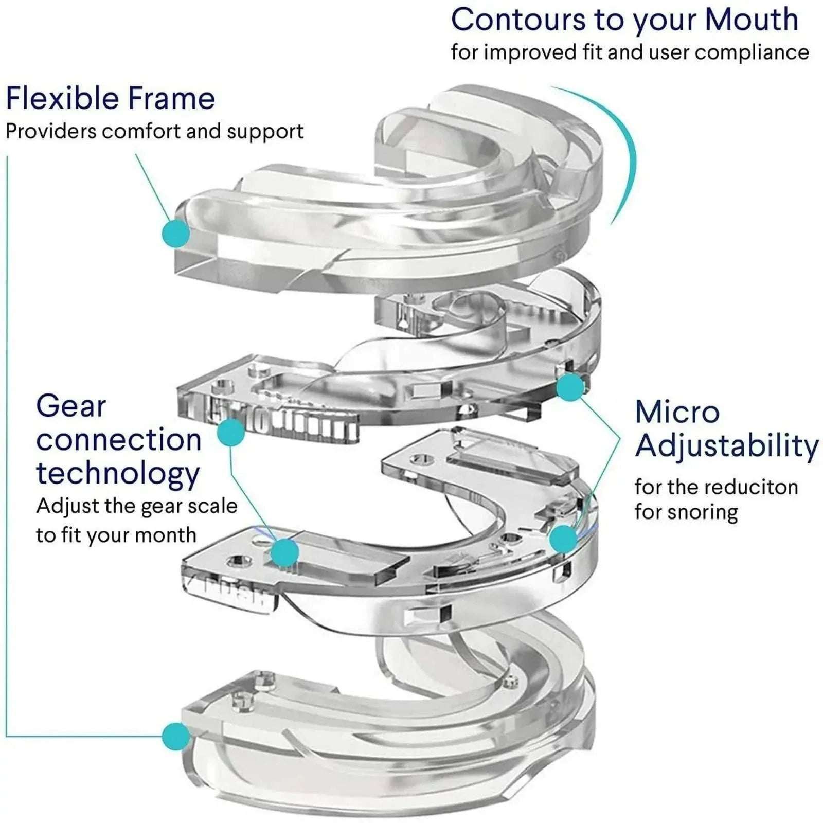 Adjustable anti-snoring mouth guard with flexible frame, gear connection technology, and micro adjustability for customizable fit and snoring reduction.