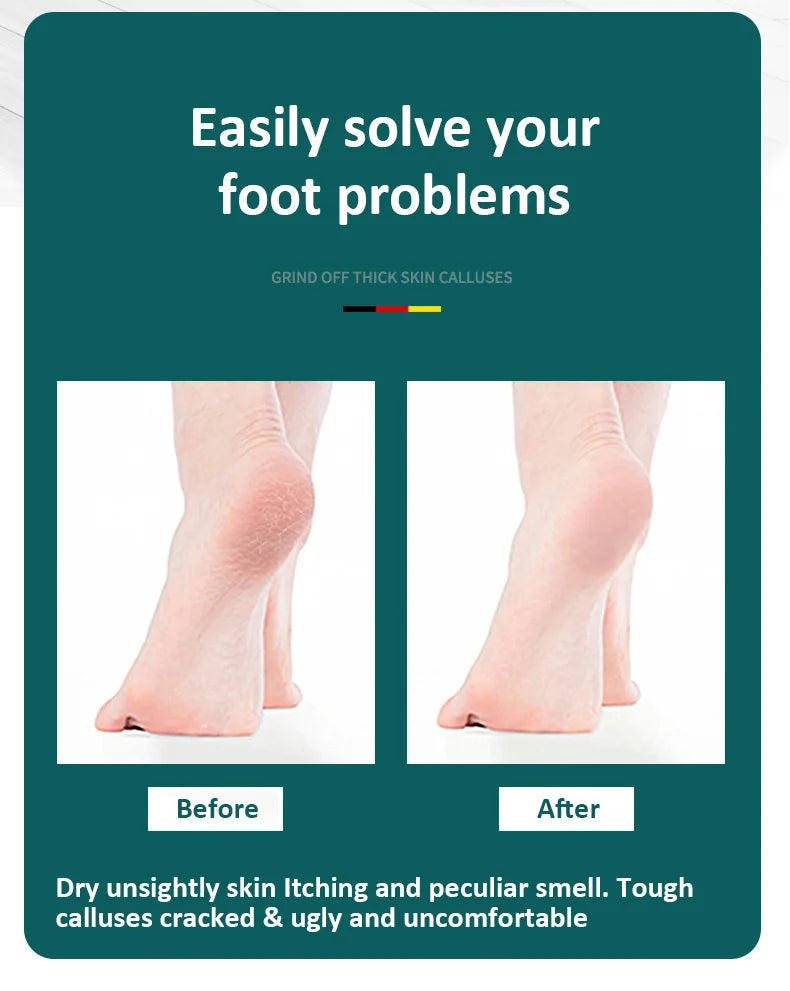 High-Quality 304 Stainless Steel Foot File – Double-Sided Callus Remover