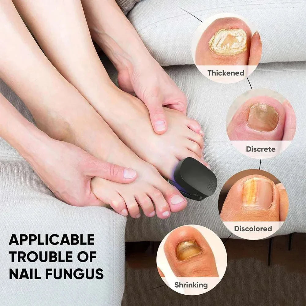 Nail care device treating fungal, thickened, discolored, and ingrown toenails for healthier nails at home