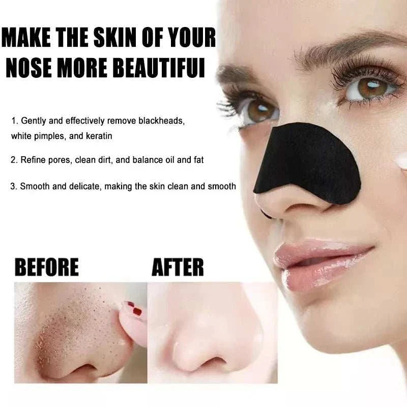 Facial blackhead removal stickers applied on nose for deep pore cleansing and blackhead removal before and after results