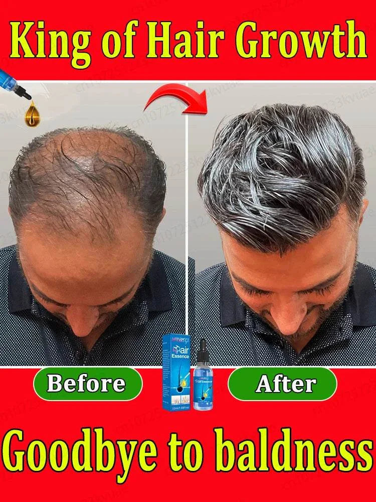 Before and after images showing effective hair growth treatment results on a balding man, promoting fuller and thicker hair.