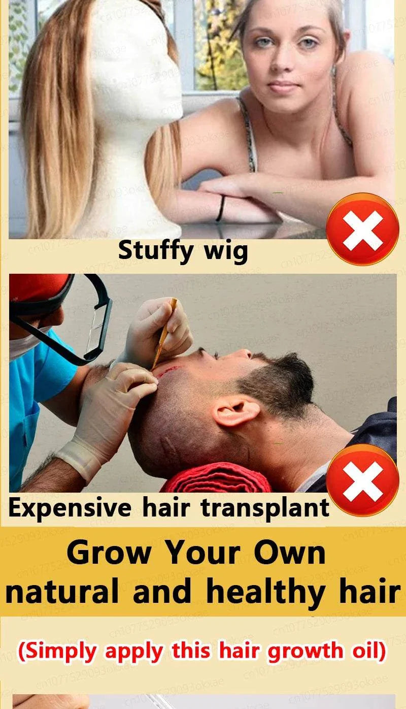 Comparison of hair growth treatment versus stuffy wig and expensive hair transplant promoting natural healthy hair growth with topical application of hair growth oil