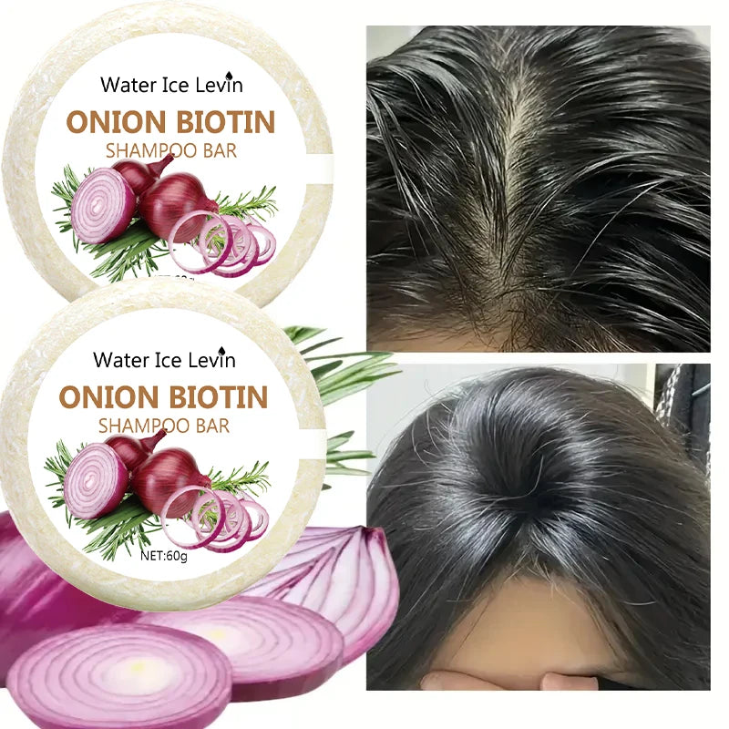 Onion and Biotin Shampoo Soap