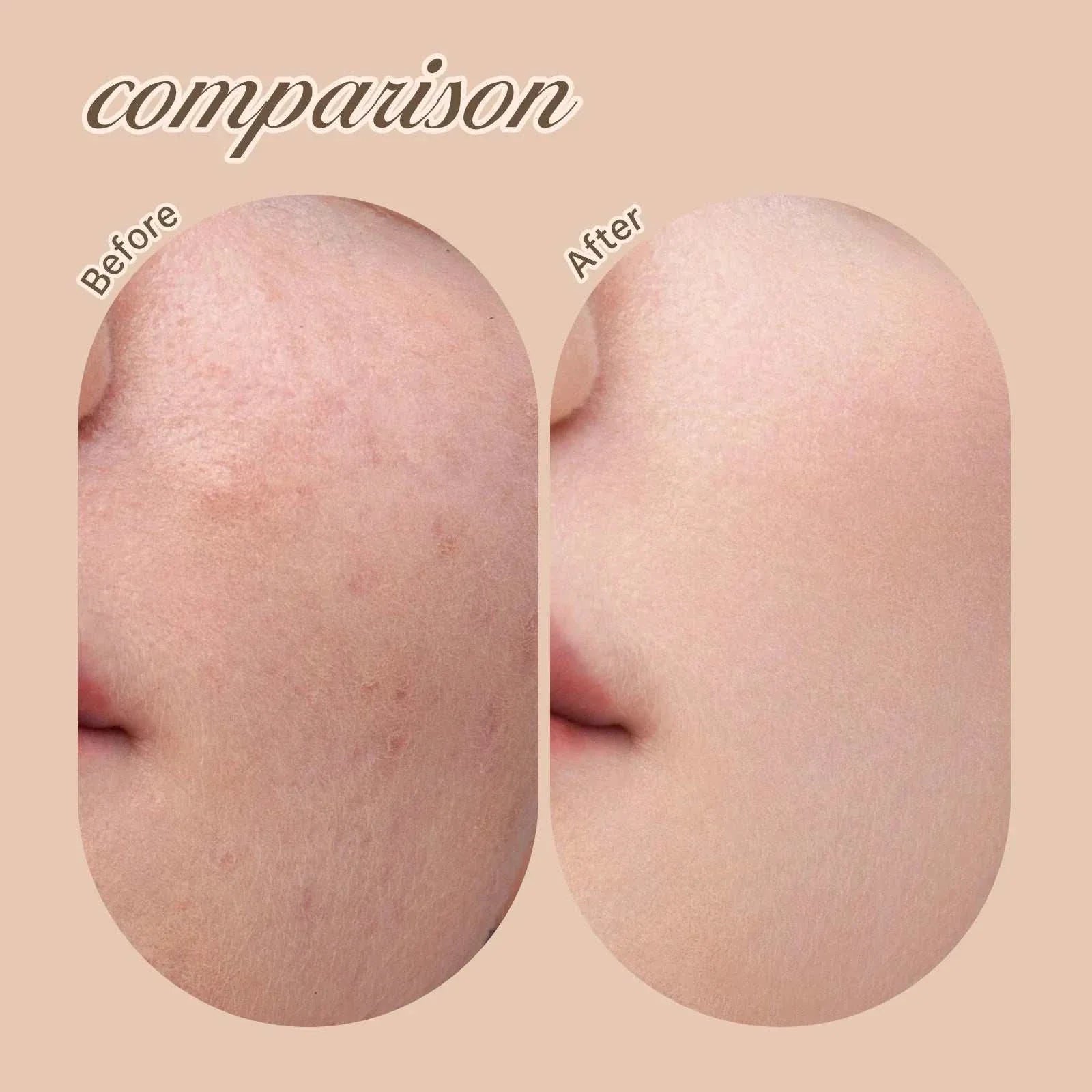 Before and after close-up comparison of skin showing coverage of blemishes and redness using liquid concealer stick foundation cream