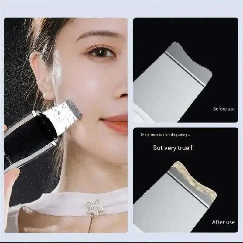 Blackhead remover facial pore cleanser showing before and after deep cleaning results with exfoliating device for clearer skin