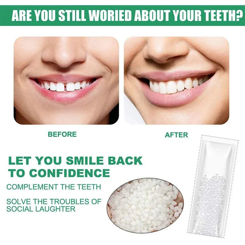 Resin Tooth Repair Glue beads with before and after images showing repaired teeth for temporary dental fixes and confident smiles