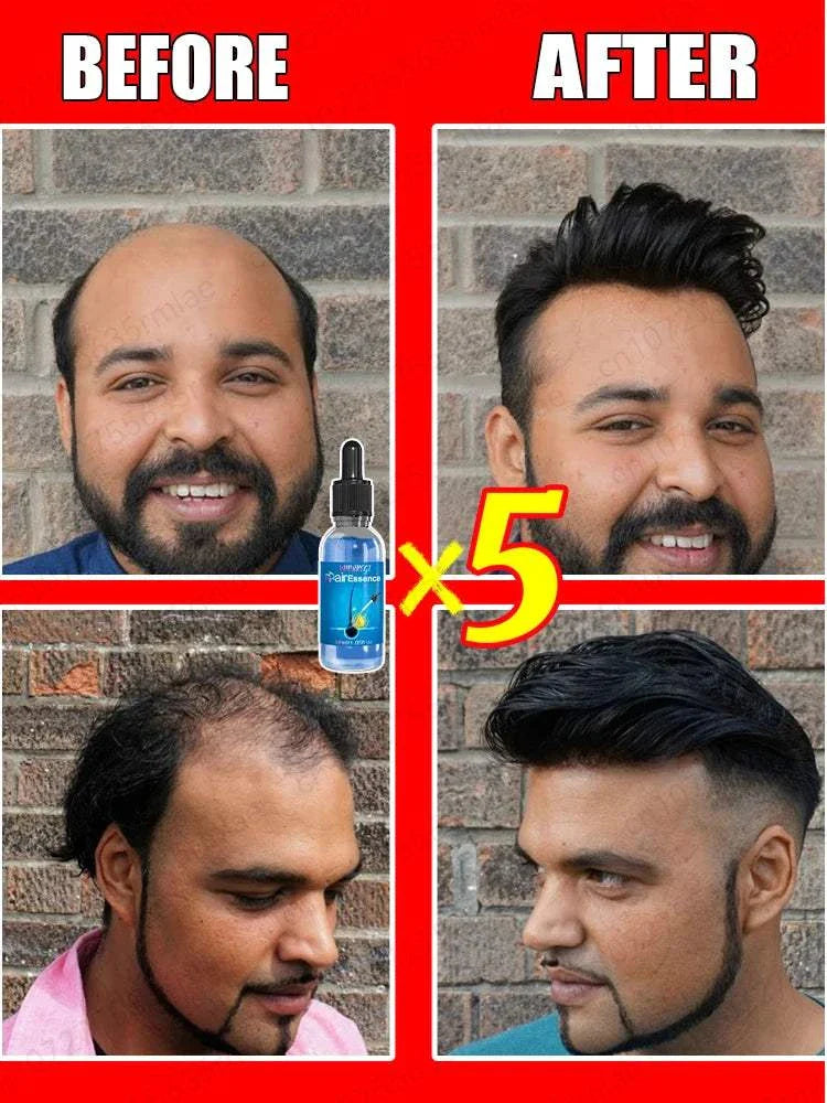 Before and after images showing significant hair regrowth results using advanced hair growth treatment.