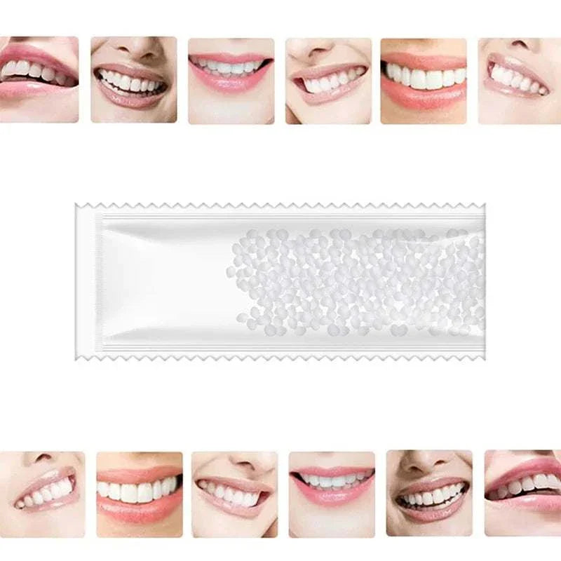 Resin tooth repair glue beads for temporary dental fixes with various smiling teeth examples showing repaired teeth results