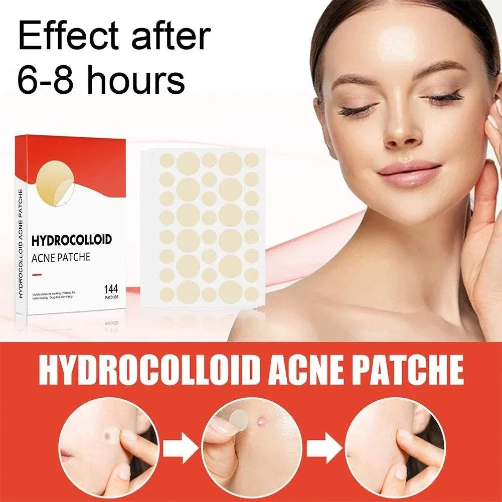 High-End Acne Patches hydrocolloid spot treatment set with 144 ultra-thin healing stickers for acne repair and protection.