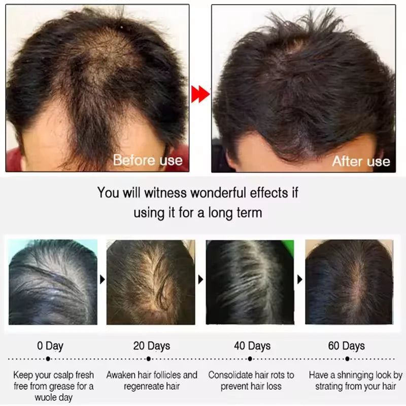 7 Days Fast Batana Oil Hair Growth Serum