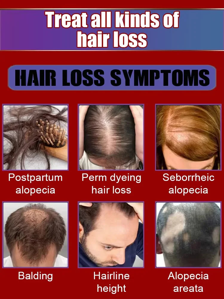 Blue Bottle Hair Growth serum treating various hair loss symptoms including postpartum alopecia, perm dyeing hair loss, seborrheic alopecia, balding, receding hairline, and alopecia areata