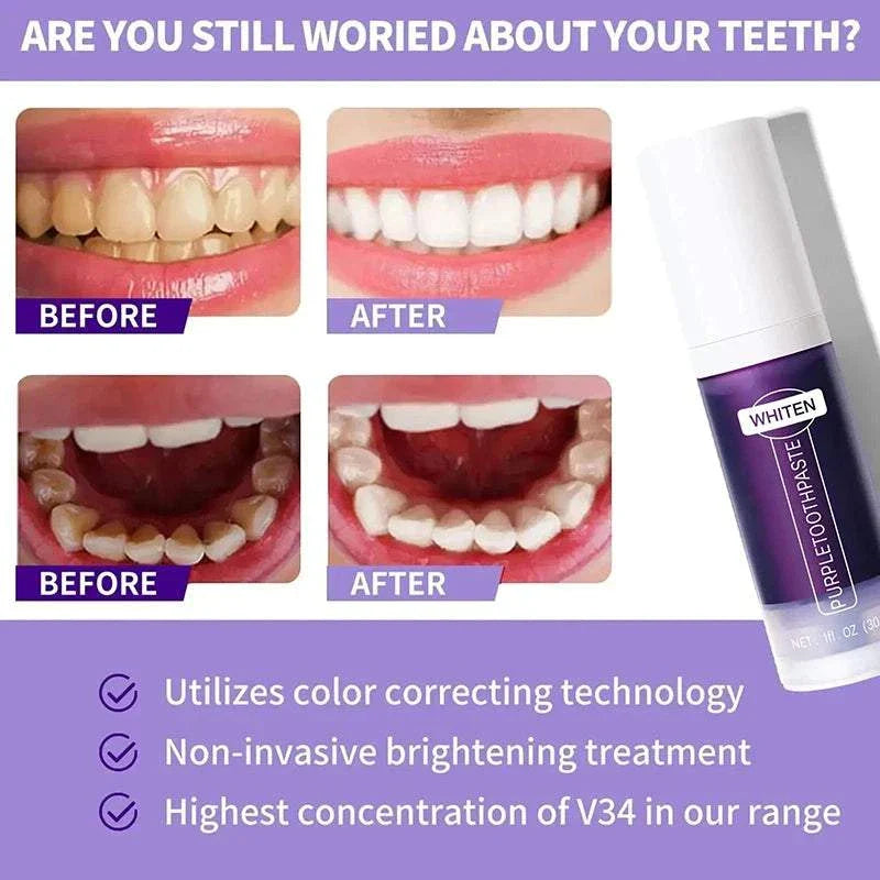 Before and after results of teeth whitening using the New 5D Teeth Whitening Stick with color correcting technology and non-invasive treatment shown alongside product stick.