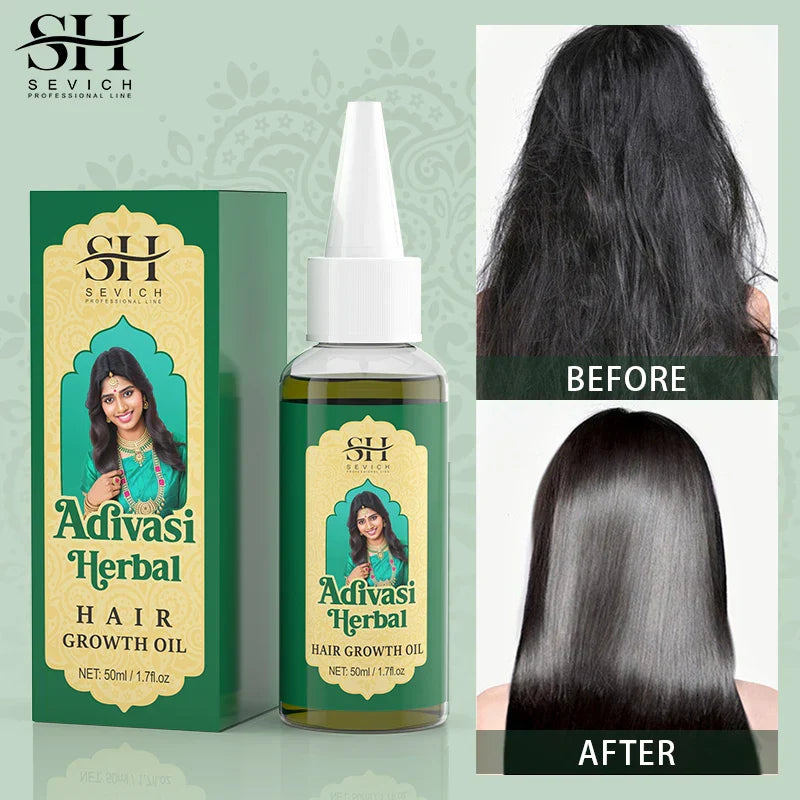 Ayurvedic Hair Growth Oil bottle and packaging with before and after images showing hair regrowth and shine