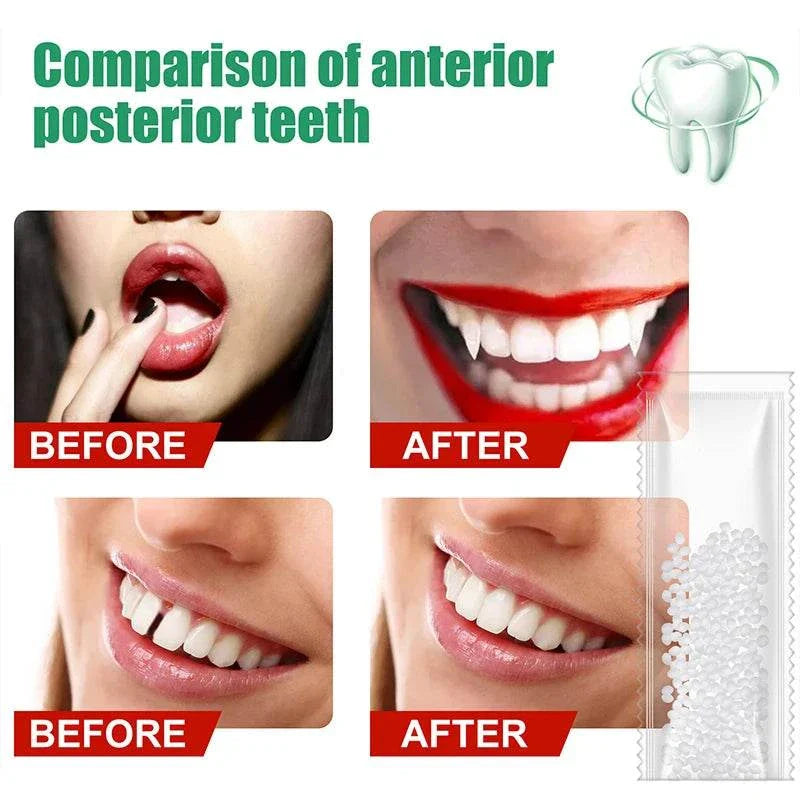 Comparison of anterior and posterior teeth before and after using Resin Tooth Repair Glue for temporary dental repair and gap filling