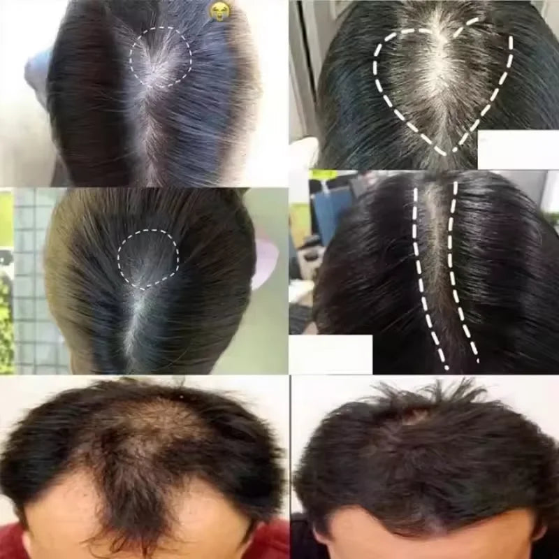 7 Days Fast Batana Oil Hair Growth Serum