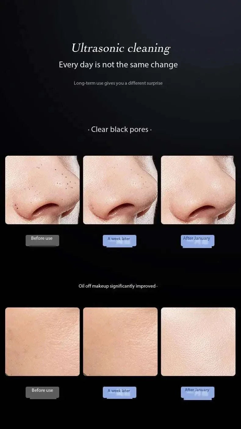 Blackhead remover device showing ultrasonic cleaning effects with before and after images of clearer pores and improved skin texture.