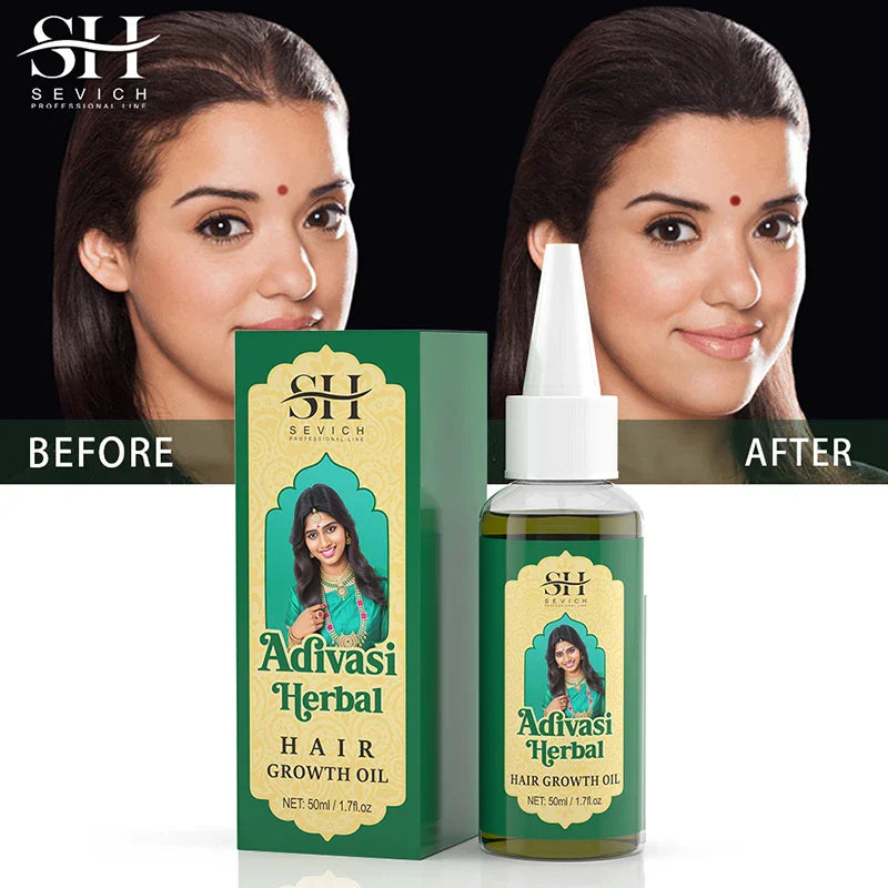 Ayurvedic Hair Growth Oil with Adivasi Herbal blend for fast hair regrowth and thicker, shinier hair before and after results.