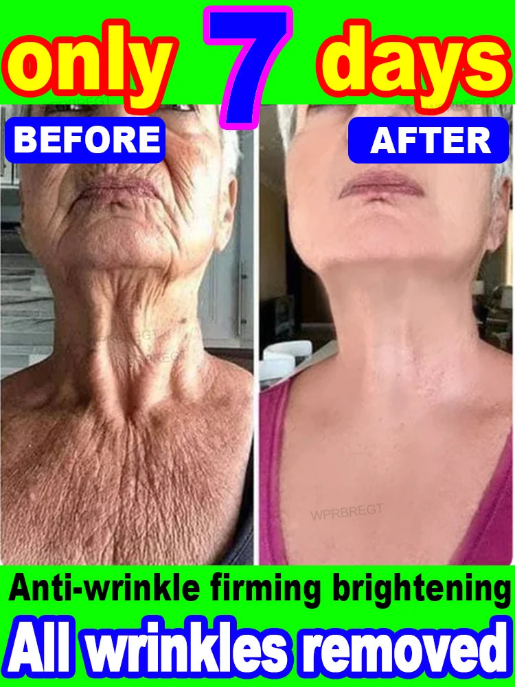 20 years younger, 100% wrinkles disappear