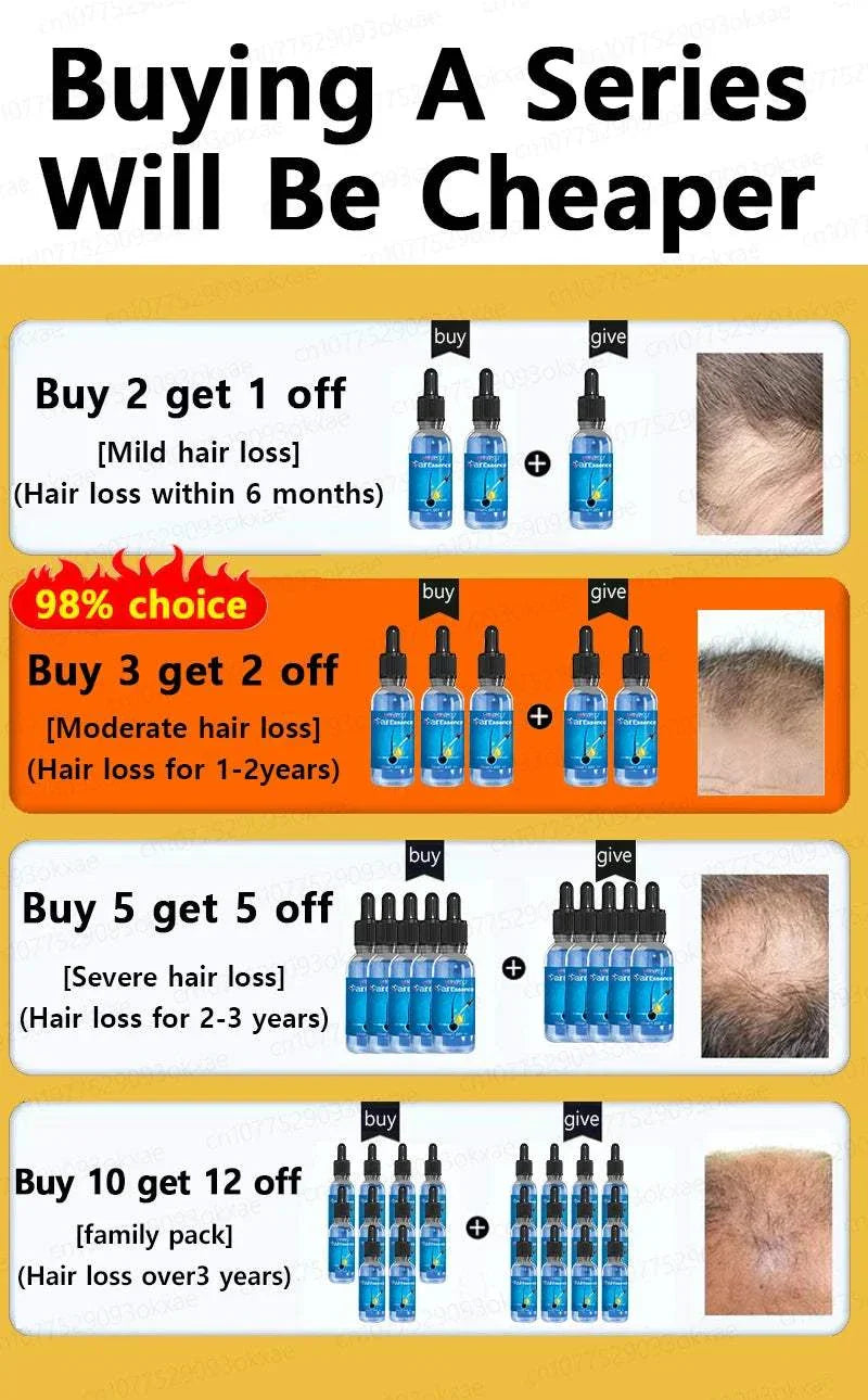 Hair Growth Treatment promotional chart showing tiered discount offers with before and after images for mild, moderate, severe, and long-term hair loss.