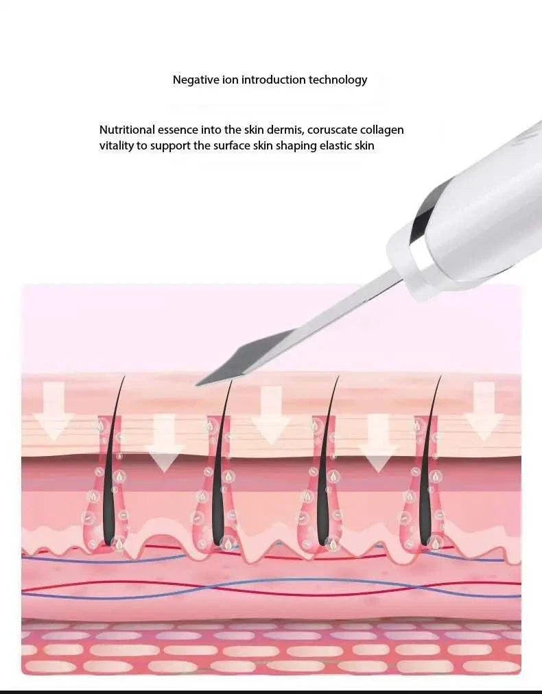 Blackhead remover device demonstrating deep pore cleansing with negative ion technology for skin revitalization.