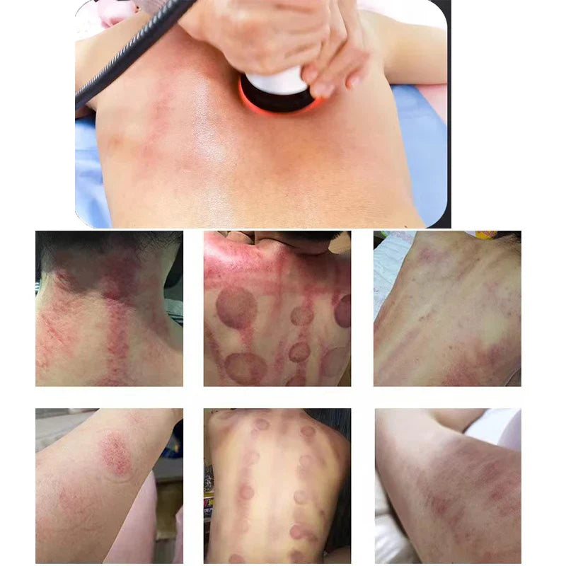 4 In 1 40k Cavitation ultrasonic body care tool used for fat reduction and skin rejuvenation on back and arms