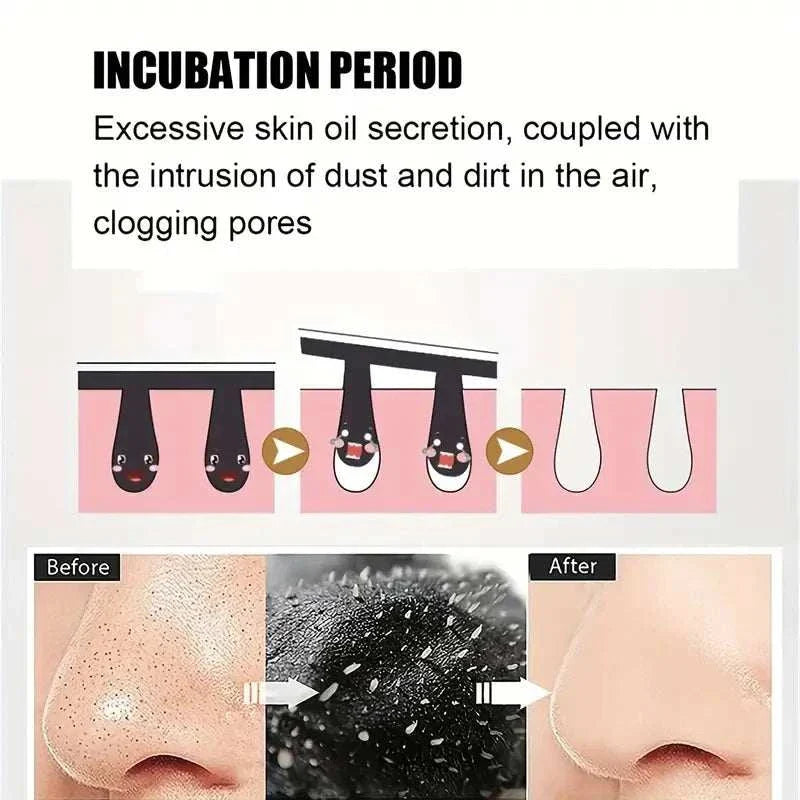 Bamboo Charcoal Nasal Strips for deep pore cleansing and blackhead removal on nose with before and after results