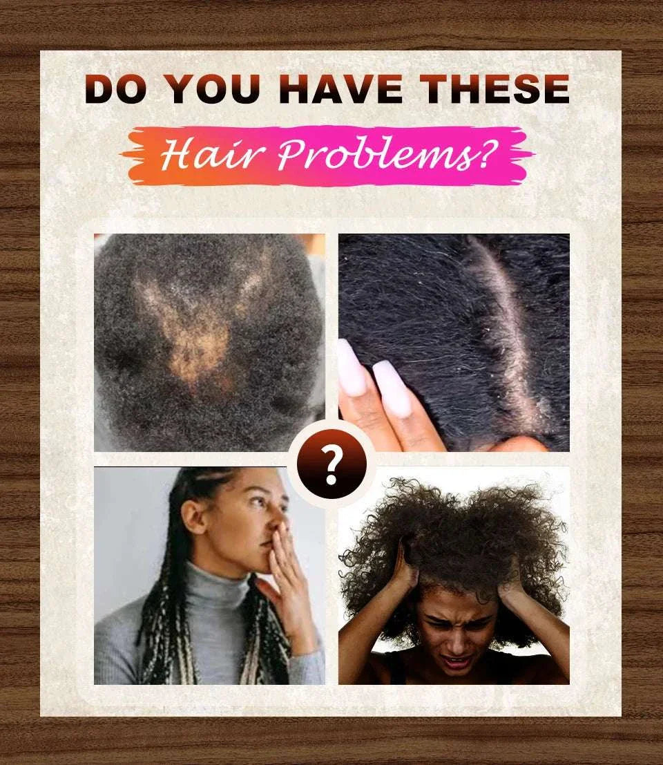 Collage showing common hair problems like thinning, scalp issues, and hair loss highlighting the need for African Crazy Chebe Hair Oil.