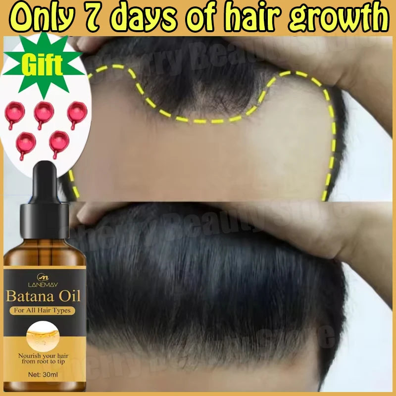 7 Days Fast Batana Oil Hair Growth Serum