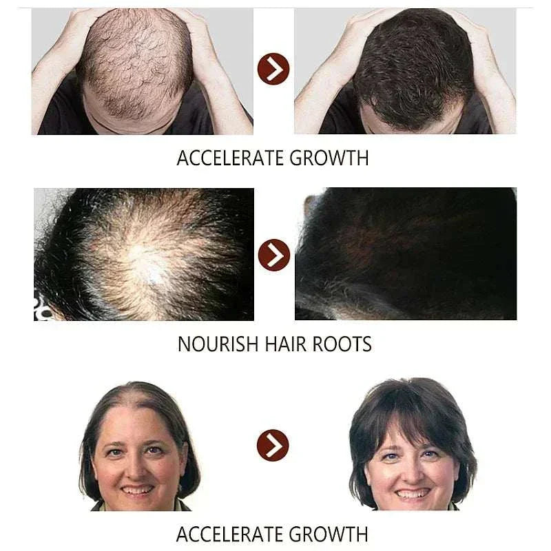 Before and after images showing rapid hair growth and improved scalp nourishment using 7 Day Rapid Growth Liquid Anti Hair Loss Treatment with ginger extract.