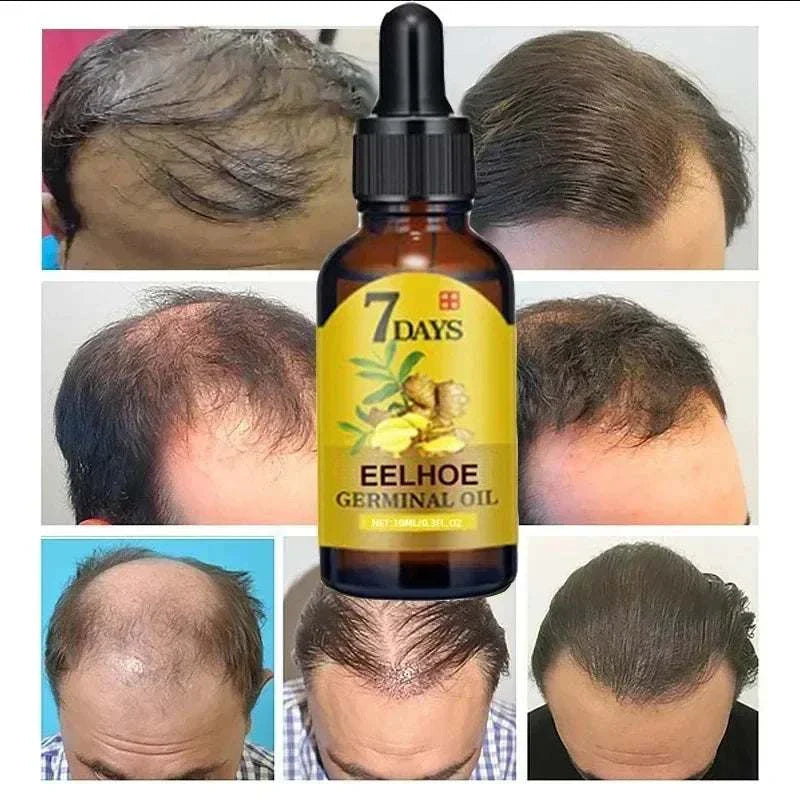 7 Day Rapid Growth Liquid Hair Loss Treatment with ginger extract showing before and after hair regrowth results